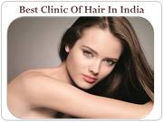  Cost of Hair Transplant in India