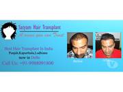 Hair Transplant Center in Chandighar