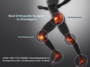 Dr. Manu Mengi - Knee and Hip Replacement Specialist in Chandigarh