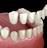 Why consider Dental Implants Best Dental Clinic in Greater Kailash