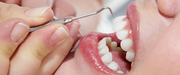 From Fillings to Root Canals Comprehensive Best Dental Clinic in Brook