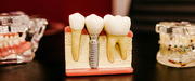 Premier Best Dental clinic in Sector 10 Chandigarh | Top-Ranked Dentis
